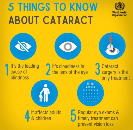 5 things to know about cataract